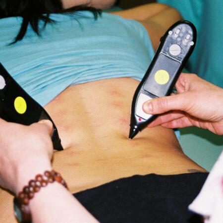The Ultimate Dolphin Neurostim & MPS Store Review: The Bio-Electrical Revolution in Chronic Pain Management, Scar Release, and Vagal Stress Reduction