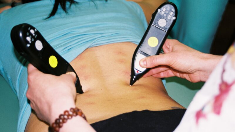 The Ultimate Dolphin Neurostim & MPS Store Review: The Bio-Electrical Revolution in Chronic Pain Management, Scar Release, and Vagal Stress Reduction