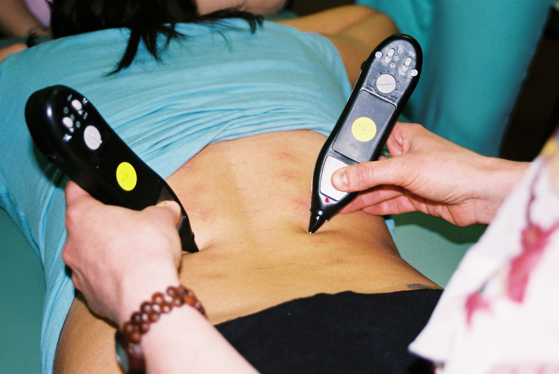 The Ultimate Dolphin Neurostim & MPS Store Review: The Bio-Electrical Revolution in Chronic Pain Management, Scar Release, and Vagal Stress Reduction